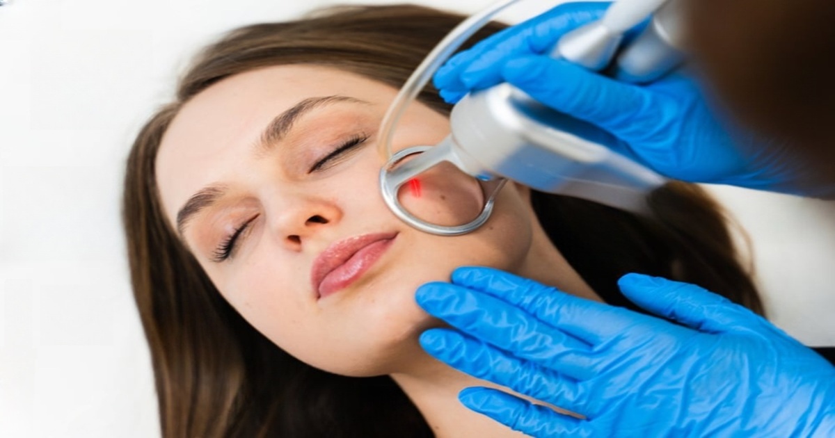 CO2 Laser Resurfacing in Webster, TX
